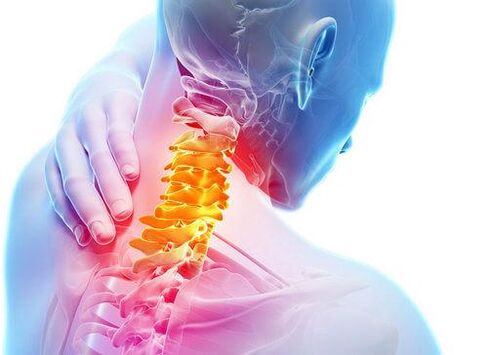 spinal lesion na may cervix osteochondrosis