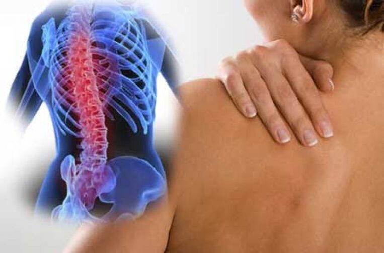 Sa panahon ng isang exacerbation ng osteochondrosis ng thoracic spine, ang sakit sa dorsago ay nangyayari. 