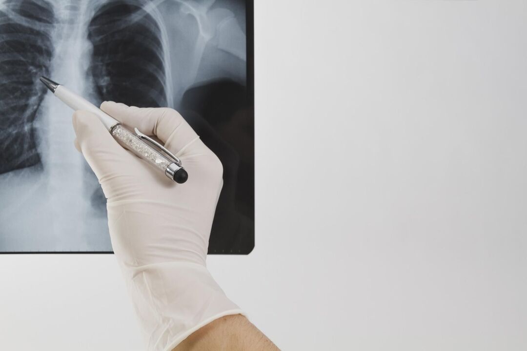 X-ray para sa pag-diagnose ng osteochondrosis