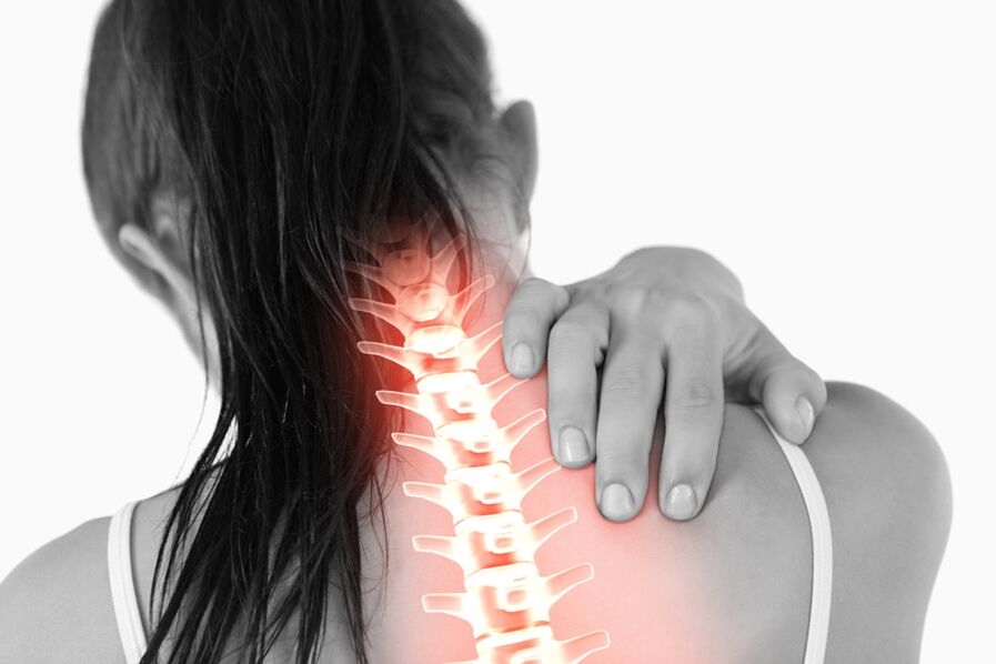 Ang sakit dahil sa osteochondrosis ng thoracic spine sa mga kababaihan ay maaaring mag-radiate sa lugar ng leeg