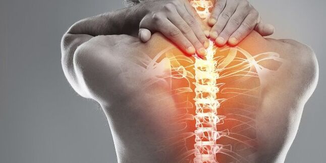 Mga opsyon na medikal para sa cervical therapy ng cervical osteochondrosis