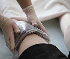 Ang mga aplikasyon ng Ozokerite sa tuhod para sa arthrosis
